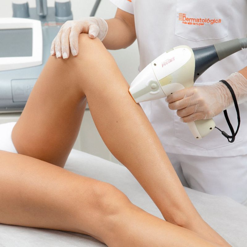 Depilacion laser vectus hot sale