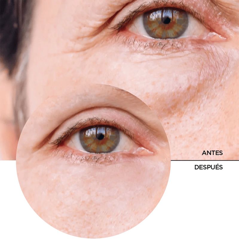Serum-Revox-Contorno-Ojos-Cafeina-30Ml