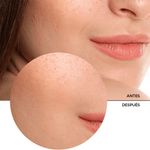 Serum-Revox-Acido-Hialuronico-5--30-Ml
