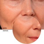 Serum-Revox-Coenzima-Q10-30-Ml