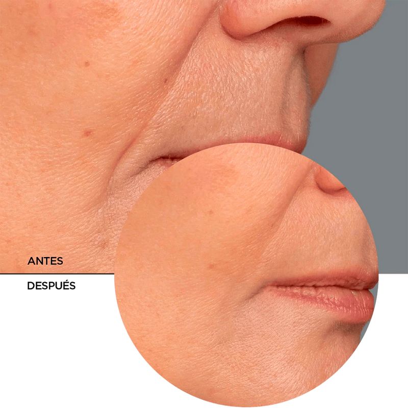 Serum-Revox-R-Retinol-Regenera-30-ML